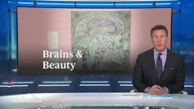 Art and Neuroscience Unite in Groundbreaking Exhibit