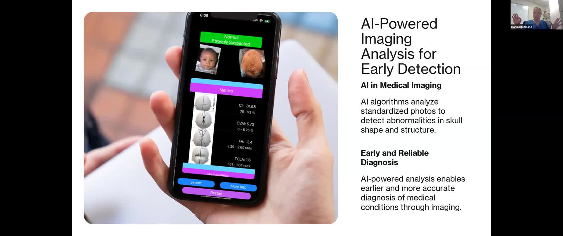 Advocates press for stronger medical-equipment accessibility and hospital lift requirements despite recent Connecticut law