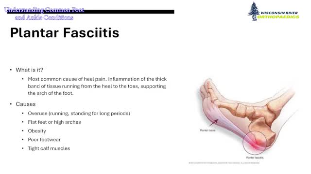 Orthopedic surgeon outlines common foot and ankle problems, conservative treatments in Wisconsin Rapids talk